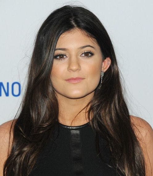 Kylie Jenner plastic surgery timeline - before and after pictures - heat