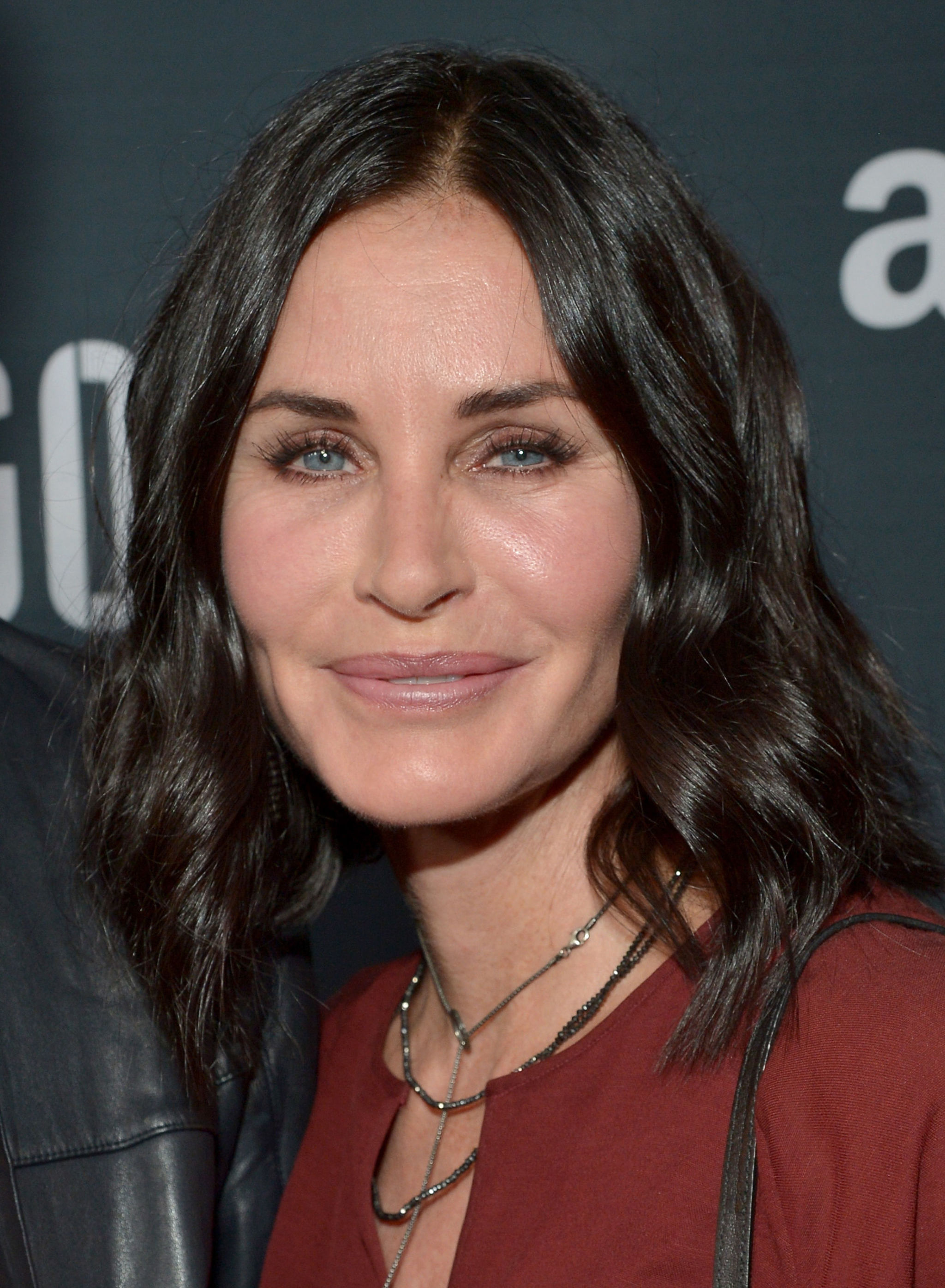 Courteney Cox plastic surgery | Courteney Cox fillers removed