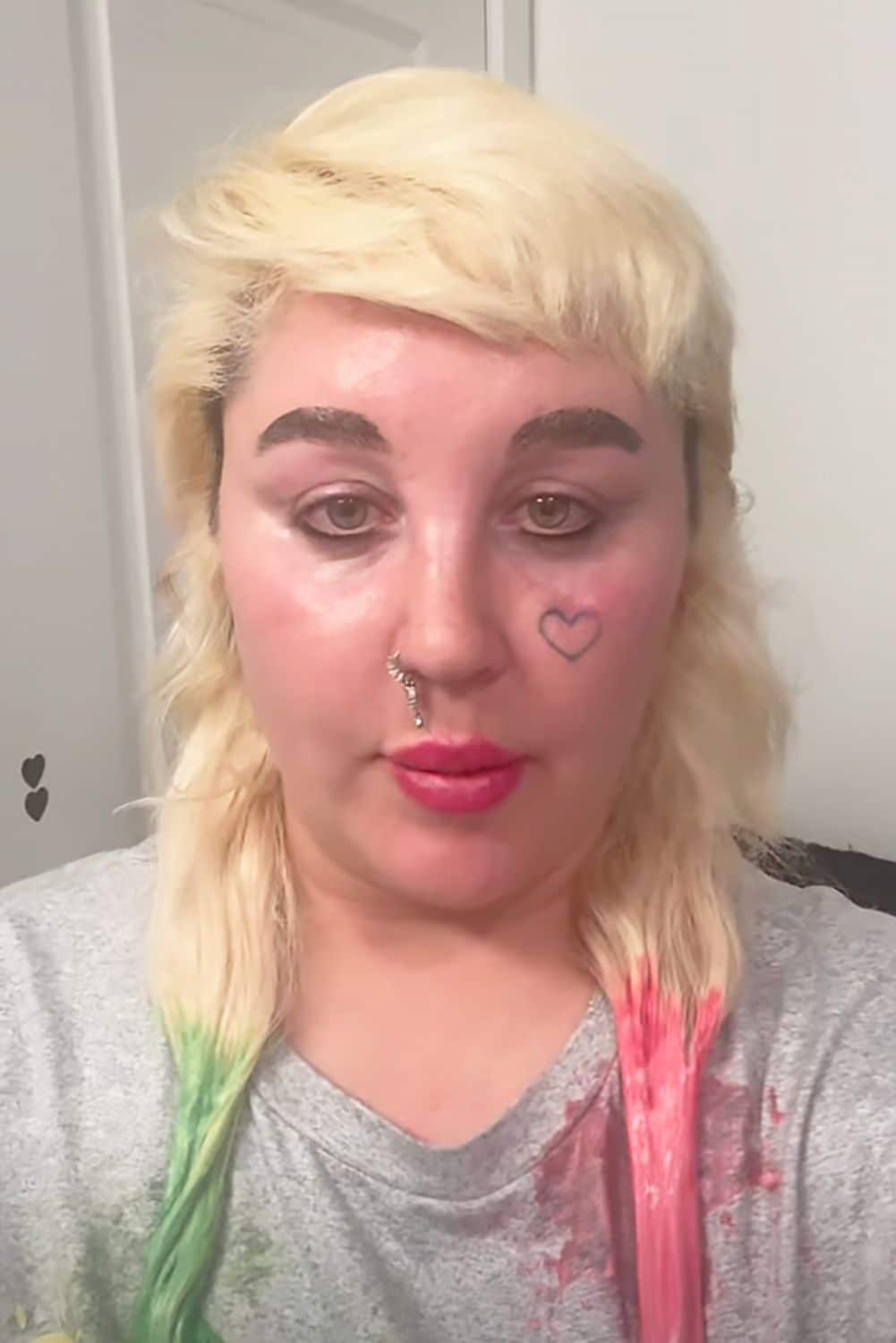 Amanda Bynes Starts Ozempic, Shares Weight Loss Goal