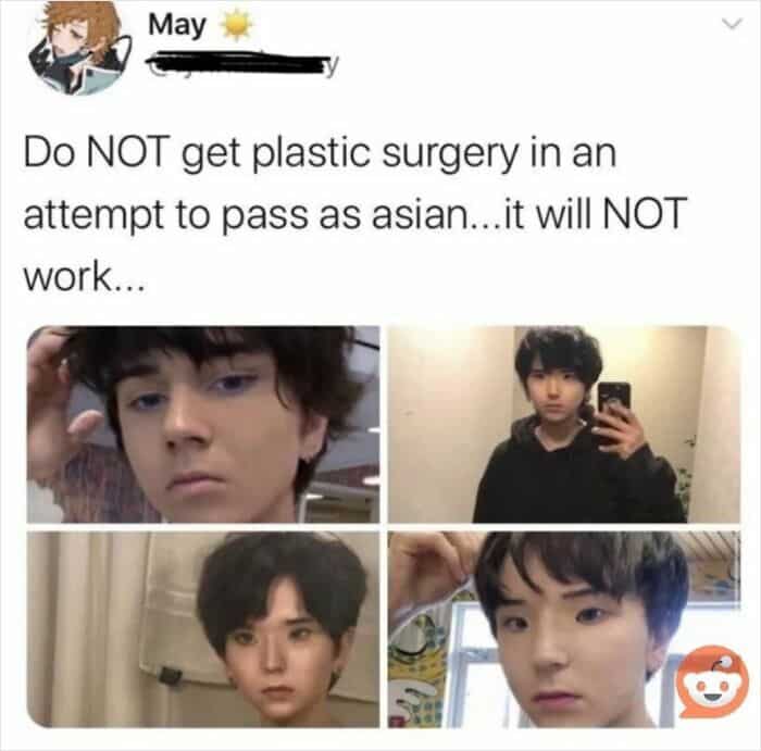 Screenshot of a cringey Instagram post showing failed plastic surgery attempts to look Asian.